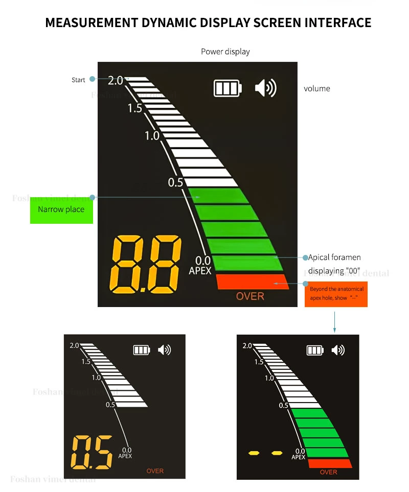 Endo Root Canal Apex Locator LCD Screen Dental Equipment